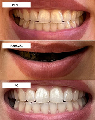 Paski wybielające zęby The White(ning) Stripes Smilebite zestaw 28 szt. - 6