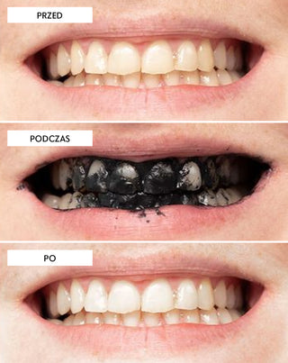 Proszek do wybielania zębów z węglem kokosowym Smilebite - 5