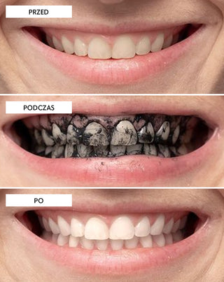 Proszek do wybielania zębów z węglem kokosowym Smilebite - 6